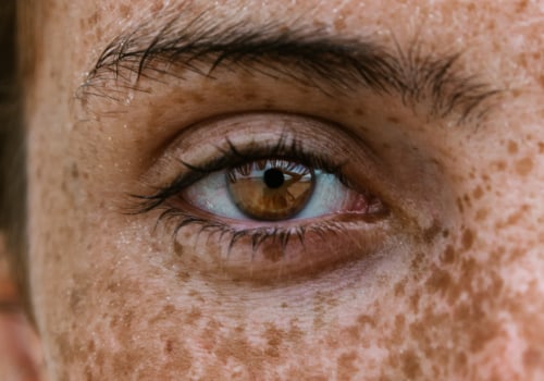 Limiti di età per il trattamento del contorno occhi