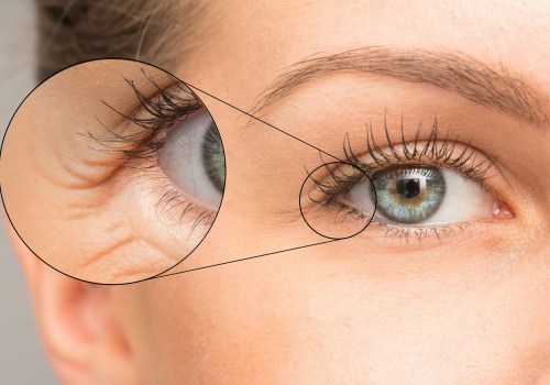 Posso usare farmaci da banco dopo il trattamento del contorno occhi?